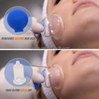 FacialCupping de cristal fijó las tazas del masaje de la succión del vacío del PVC, sistemas linfáticos de la terapia, sistema de ahuecamiento del grado profesional